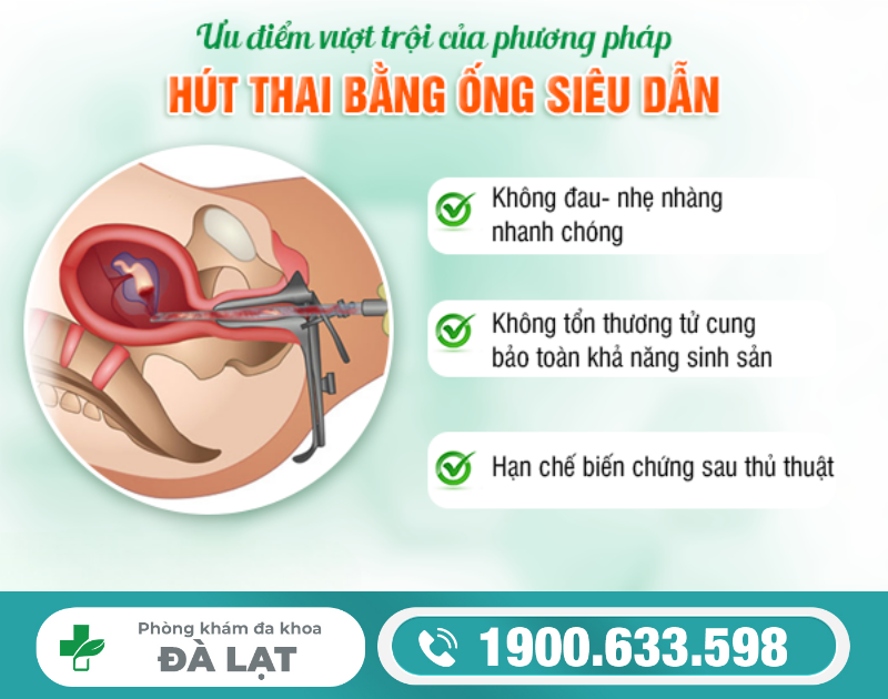 Hình ảnh minh họa